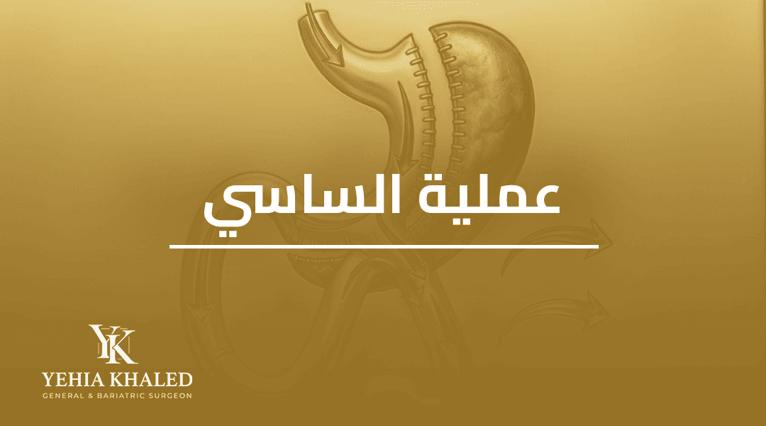 عملية الساسي