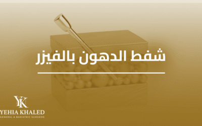 عملية شفط الدهون بالفيزر