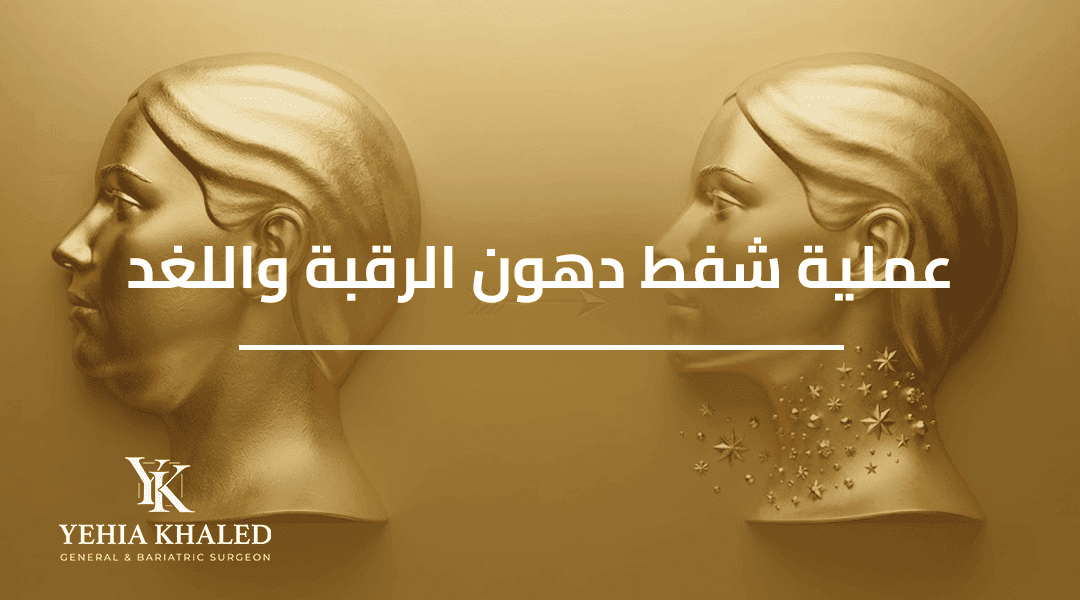عملية شفط دهون الرقبة واللغد