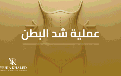 عملية شد البطن (شد – شفط)