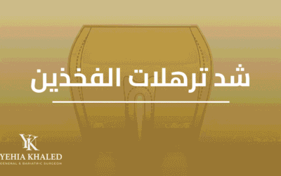 عملية شد ترهلات الفخذين