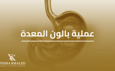 عملية بالون المعدة