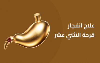 انفجار قرحة الإثنى عشر