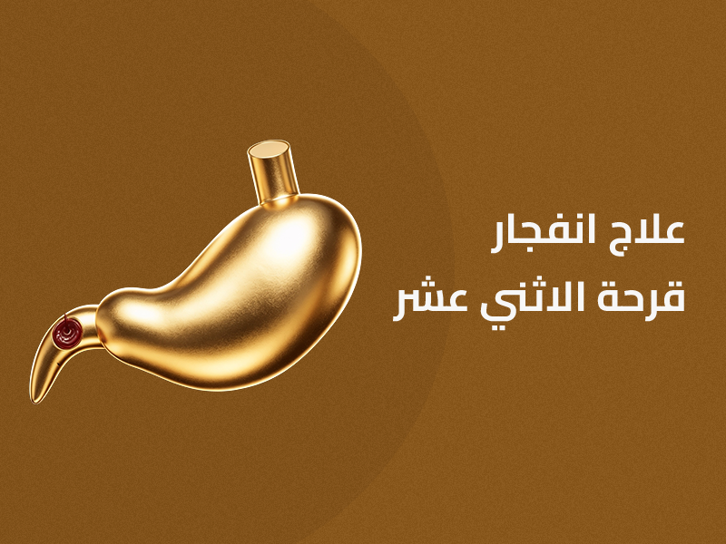 انفجار قرحة الإثنى عشر