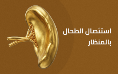 استئصال الطحال بالمنظار