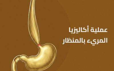 عملية أكاليزيا المريء بالمنظار