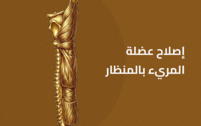 إصلاح عضلة المريء بالمنظار
