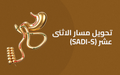 تحويل مسار الإثنى عشر SADI-S