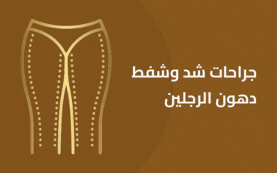 جراحات شد وشفط الرجلين