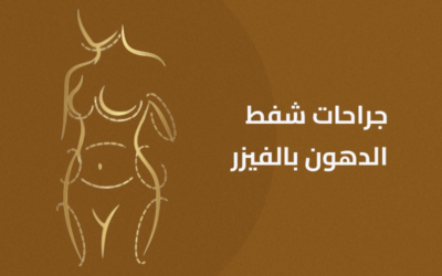 جراحات شفط الدهون بالفيزر