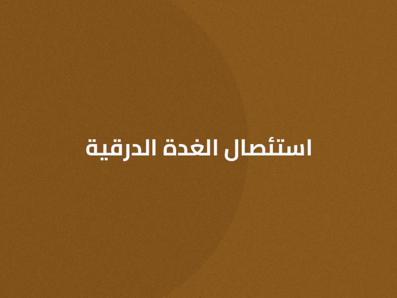 علاج واستئصال الغدة الدرقية