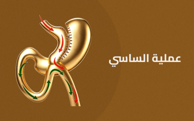 عملية الساسي