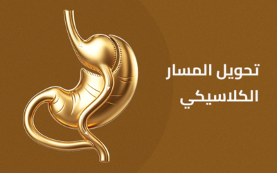 تحويل المسار الكلاسيكي بالمنظار