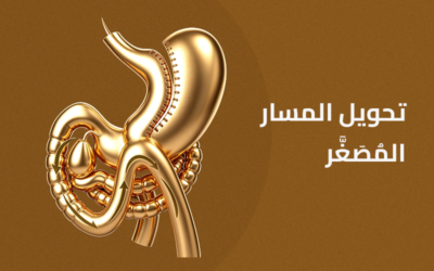 تحويل المسار المصغر بالمنظار
