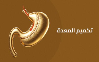 تكميم المعدة بالمنظار