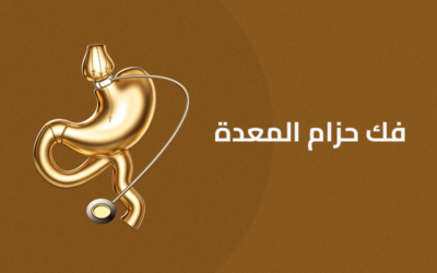 فك حزام المعدة