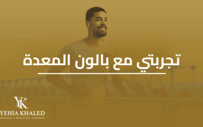 تجربتي مع بالون المعدة