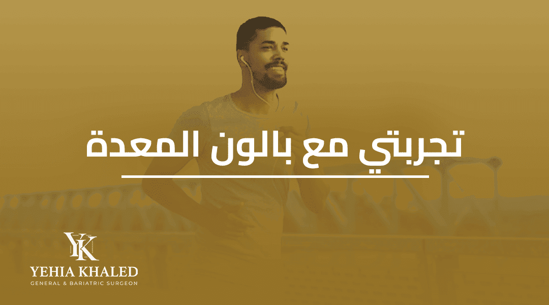تجربتي مع بالون المعدة