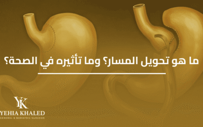 ما هو تحويل المسار؟ وما تأثيره في الصحة؟