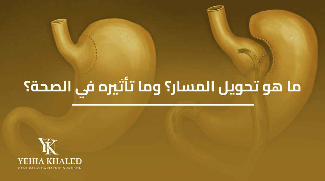 ما هو تحويل المسار؟ ما هو تحويل المسار؟