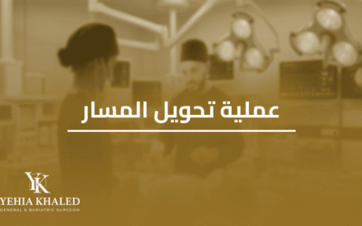 عملية تحويل المسار