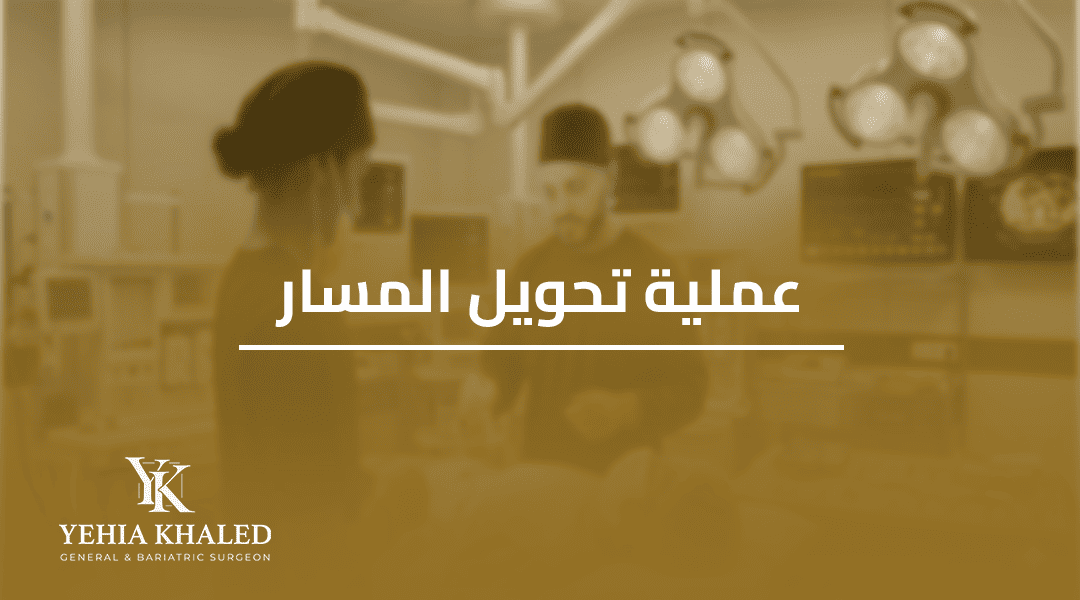 عملية تحويل المسار