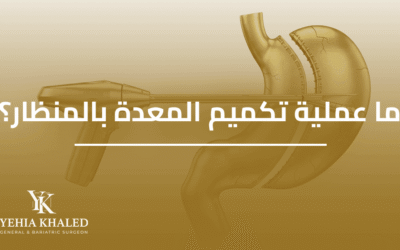 ما هي عملية تكميم المعدة بالمنظار | دليلك الشامل