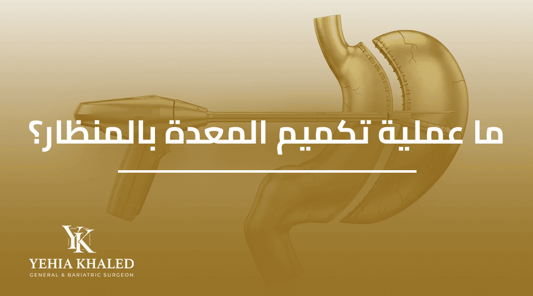 ما هي عملية تكميم المعدة بالمنظار | دليلك الشامل