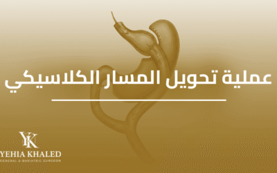 عملية تحويل المسار الكلاسيكي | دليلك الشامل