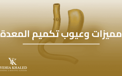 ماهي مميزات وعيوب عملية تكميم المعدة 2026