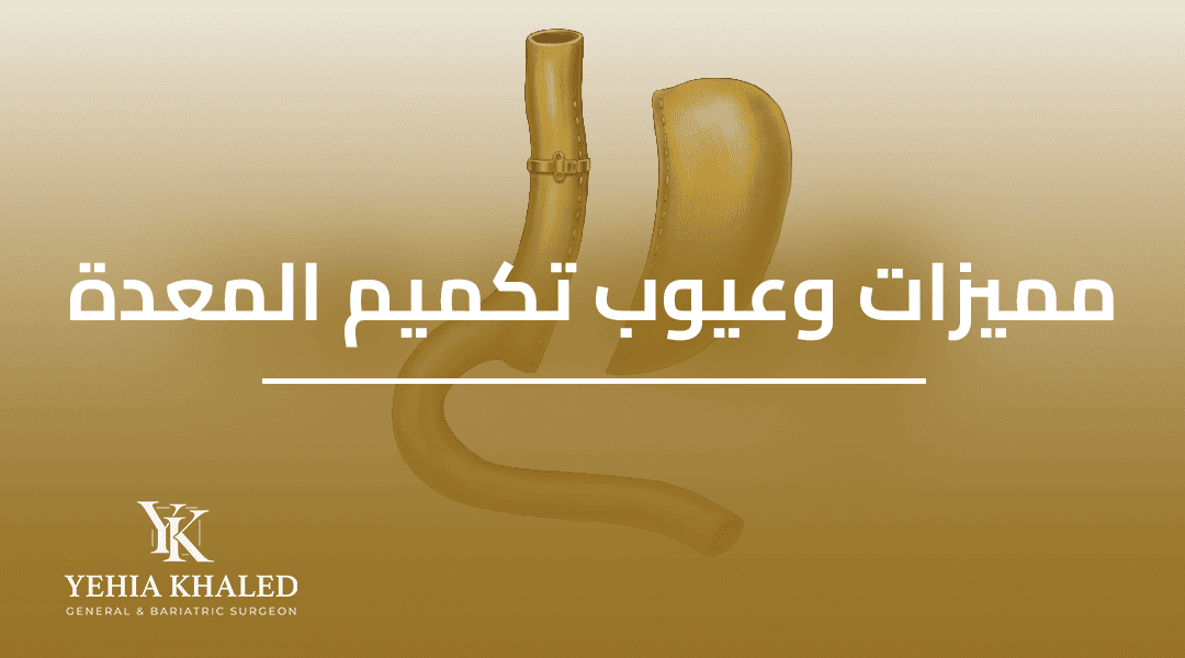 ماهي مميزات وعيوب عملية تكميم المعدة 2026