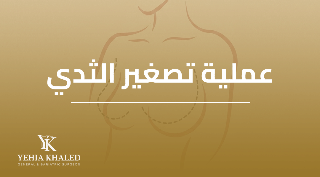 عملية تصغير الثدي