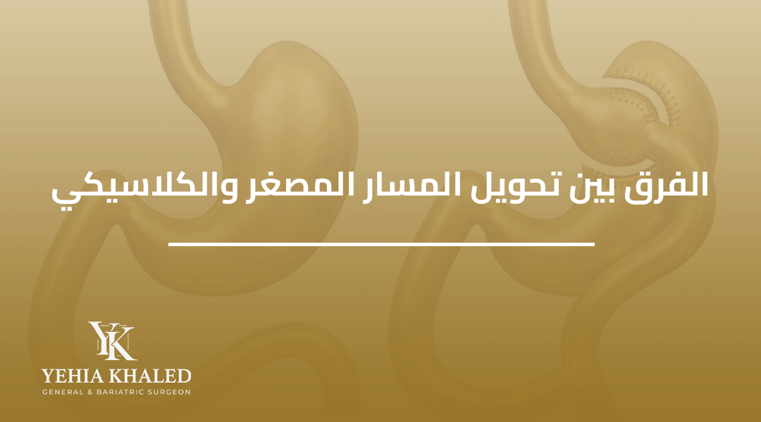 عملية تحويل المسار المصغر