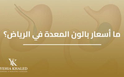 ما اسعار بالون المعدة الرياض؟ 2026-2027