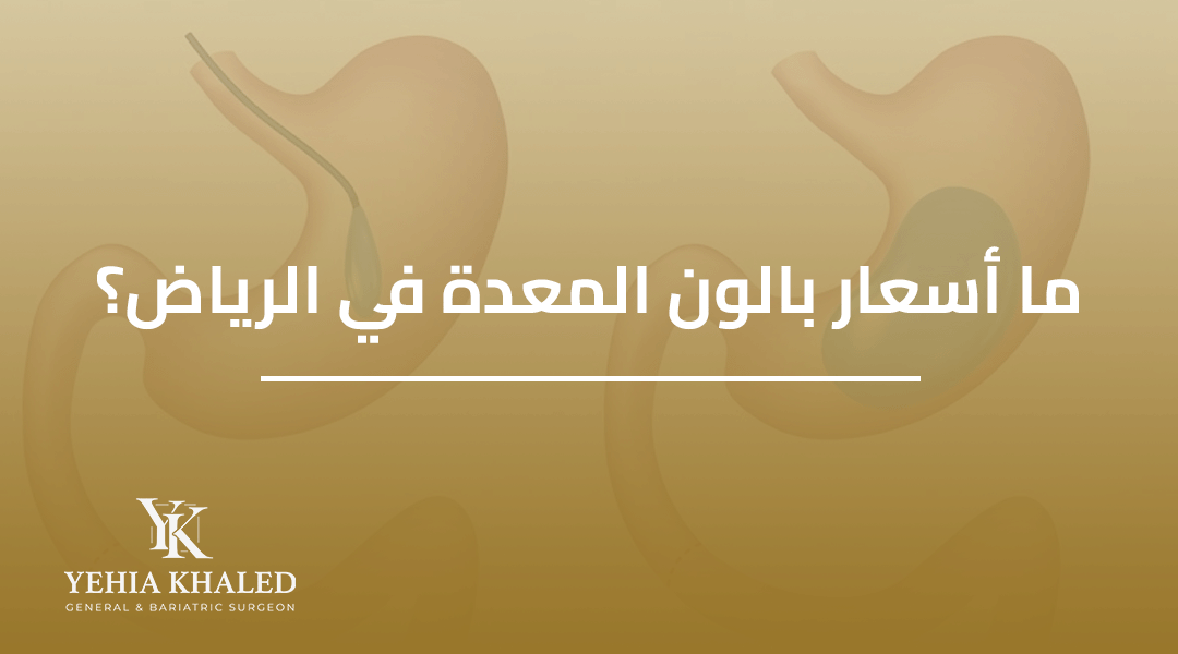 بالون المعدة الرياض