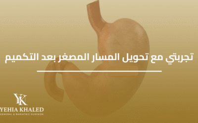 تجربتي مع تحويل المسار المصغر بعد التكميم