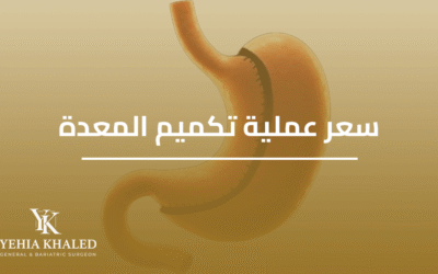 سعر عملية تكميم المعدة في 2026