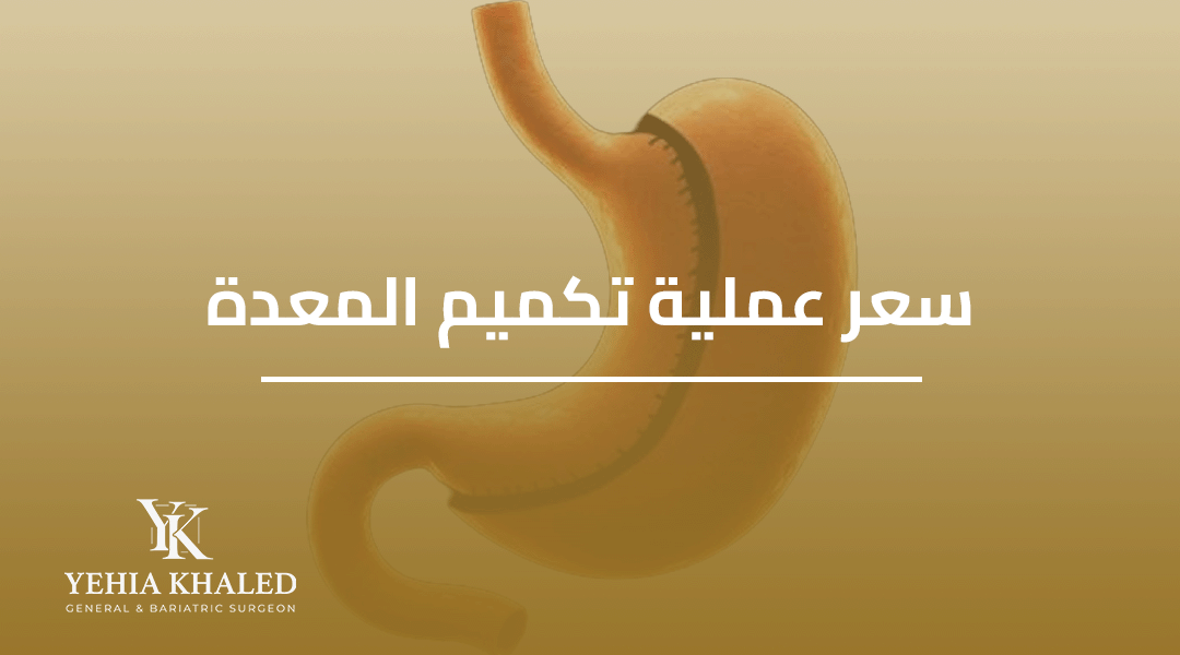 سعر عملية تكميم المعدة
