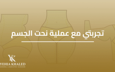 تجربتي مع عملية نحت الجسم | رحلة نحت الجسم كاملة
